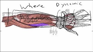 Wrist Tendonitis Symptoms Basics  The Actual Causes [upl. by Loretta]