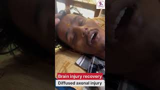 Diffused axonal injury strokepatient strokepatient education strokesurvivor nervoussystem [upl. by Akedijn539]