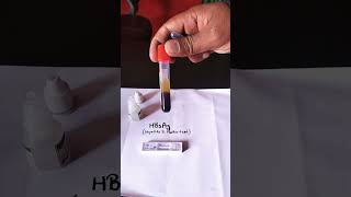 hbsag test  hbsag positive test  hbsag test kya hota hai  shorts  youtubeshorts  hbsag [upl. by Sosanna]