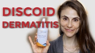 DISCOID NUMMULAR DERMATITIS TIPS FROM A DERMATOLOGIST DR DRAY [upl. by Dorcia]