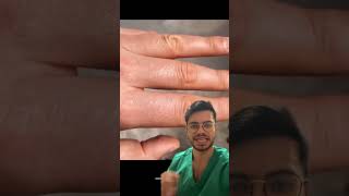 Dehydration clinical sign dayinthelifeofamedstudent doctor doctorreacts doctorreacts [upl. by Maghutte]