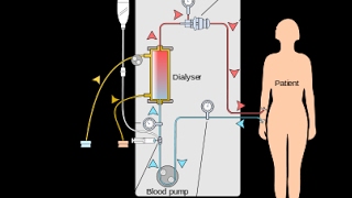 lhémodialyse Le mécanisme daction الية العمل تصفية الدم [upl. by Aivin]