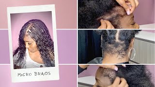 Micro Braids 2021  On REALLY Short Nape and Edges [upl. by Aihsel241]