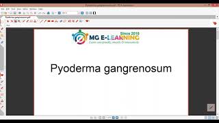 Pyoderma Gangrenosum  Dermatology  Davidson Medicine [upl. by Normac577]