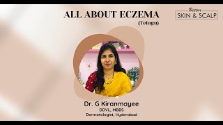 All about Eczema  Dr G Kiranmayee Hyderabad Telugu [upl. by Mairb]