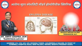 Epilepsy Patient Treated by Dr Arpit Chopra Jain [upl. by Alyakem]