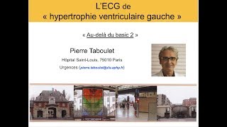 7c Hypertrophie ventriculaire gauche Au delà du basic partie 2 ECG Dr Taboulet [upl. by Nylsirhc391]