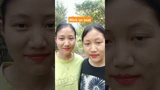 Blinking challenge shortsviral blink challenge [upl. by Grory]