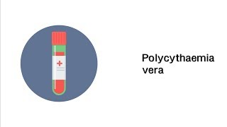 Polycythaemia vera  Polyzythämie  Erkrankungen des Blutes [upl. by Asila]