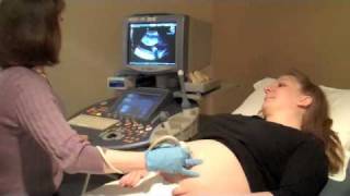 Maternity Pregnancy Ultrasound [upl. by Ilrahs]