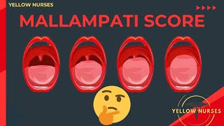 Mallampati classification score to identify difficult airway [upl. by Gnauq771]