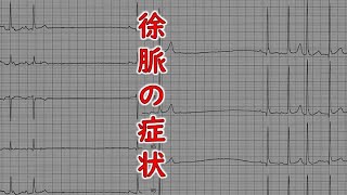 看護師国家試験 循環器 徐脈 失神 アダムス・ストークス症候群 ホルター心電図 心臓専門医 米山喜平 [upl. by Shina]