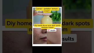 DIYAcne dark spots cream carrotpotatolemon ingredients acnescars darkspotsremove shortsvideo [upl. by Ajay965]