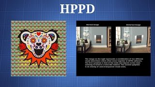 Hallucinogen Persisting Perception Disorder HPPD What You Need To Know [upl. by Nytnerb]