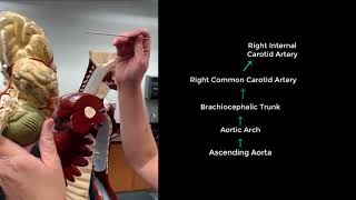 Anatomy of the Circulatory System  Arteries from the Heart to the Brain via the Carotid Arteries [upl. by Ardnuahsal]