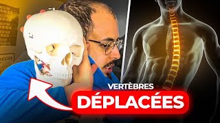 VERTÈBRES DEPLACÉES  Fake ou réalité [upl. by Angadresma786]