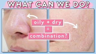 When Your Pores are Oily amp Skin is Dry at the Same Time Combination Skin Tips [upl. by Alliw345]