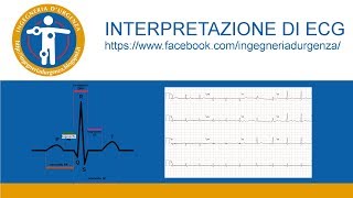 Interpretazione di ECG leggiamo insieme qualche elettrocardiogramma [upl. by Labotsirc]