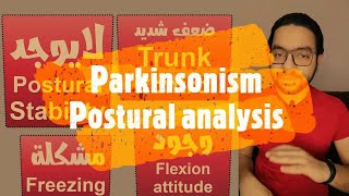 Postural analysis in Parkinsonism [upl. by Ezarra]