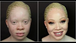 Amazing makeup transformation on Albino Skin [upl. by Kala699]