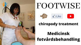 Footwise Chiropody Treatment [upl. by Edmunda]