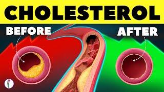 10 Natural Ways to Clear Your Artery  High Cholesterol  LDL  HDL  Heart Attack prevention tips [upl. by Cleasta]