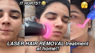 This is how LASER HAIR REMOVAL TREATMENT is done AT HOME 🫣 must watch ⁉️ [upl. by Maudie110]