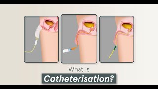 4 Minute Learning Urinary Catheterisation Male amp Care [upl. by Ellinet969]