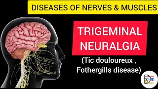 TRIGEMINAL NEURALGIA FOTHERGILLS DISEASE TIC DOULOUREUX [upl. by Andres]