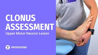 Clonus Assessment  Upper Motor Neuron Lesion [upl. by Ettedranreb]