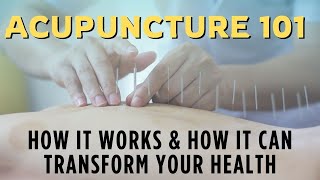 Acupuncture 101 How It Works and How It Can Transform Your Health [upl. by Belva]