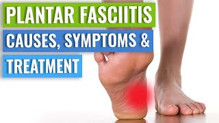 Plantar Fasciitis Causes Symptoms amp Treatment [upl. by Madelyn]