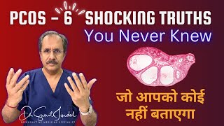 PCOS EXPERT Reveals 6 Shocking Truths You Never KnewDr Sunil JindalJindal Hospital Meerut [upl. by Gargan]