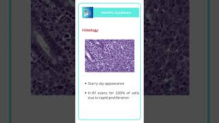 Burkitts Lymphoma  PATHOLOGY MEDICINE RAPID REVISION [upl. by Chryste74]