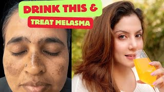 Drink this to treat Melasma amp Pigmentation  Nipun Kapur [upl. by Zeeba140]