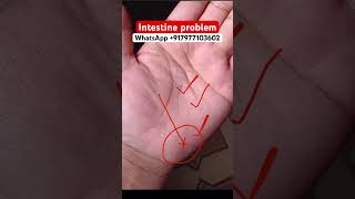 Intestine problem astrology palmanalysis palmistry palmreading palmstudy fortunetelling [upl. by Aihsiym152]