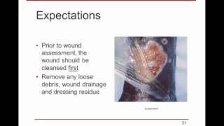 WoundRounds Webinar  Wound Assessment amp Documentation A Practical Guide [upl. by Tobiah]