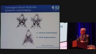 Rectocele Repair  Ronan OConnell  ICS 2016 Tokyo [upl. by Aineles903]