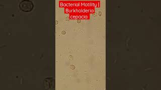 Bacterial Motility Burkholderia cepacia Blood Culture bacteremia [upl. by Poul]