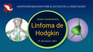 Linfoma de Hodgkin [upl. by Lrak]