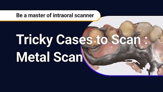 Tricky Cases to Scan  Metal Scan [upl. by Drescher]