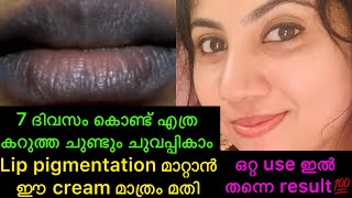 കരികട്ട ചുണ്ടും ചുമക്കാൻ ഒരു ദിവസം മതി 💯live result lipcarelippigmentation [upl. by Chapland]