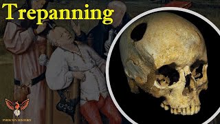 The History Of Trepanning [upl. by Yevol]