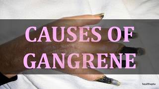 CAUSES OF GANGRENE [upl. by Aerdnaeel]