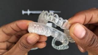 How to use Tooth Whitening Trays [upl. by Nerta]