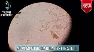 Giardia Cyst Under Microscope by YouTube Healthcare [upl. by Kannry]