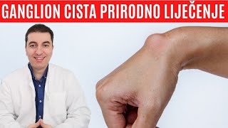 GANGLION CISTA prirodno liječenje [upl. by Ahsemik]