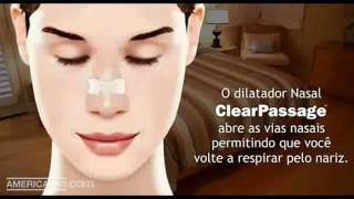 Dilatador Nasal  ClearPassage [upl. by Paradies]