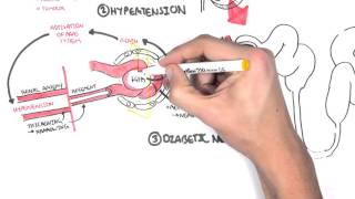 Chronic Kidney Disease CKD Pathophysiology [upl. by Sorkin]