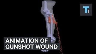 Animation of gunshot wound [upl. by Ursal]